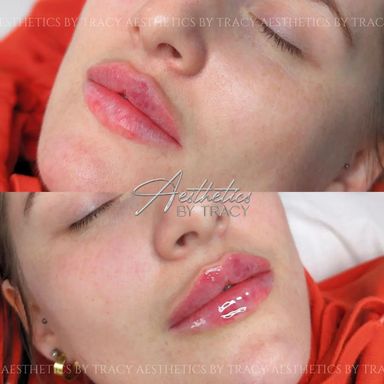 Russian Lips